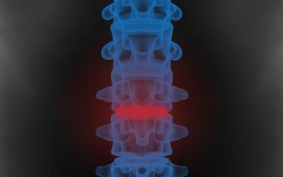 Vertebre Lombari: Anatomia, Funzioni e Prevenzione dei Dolori