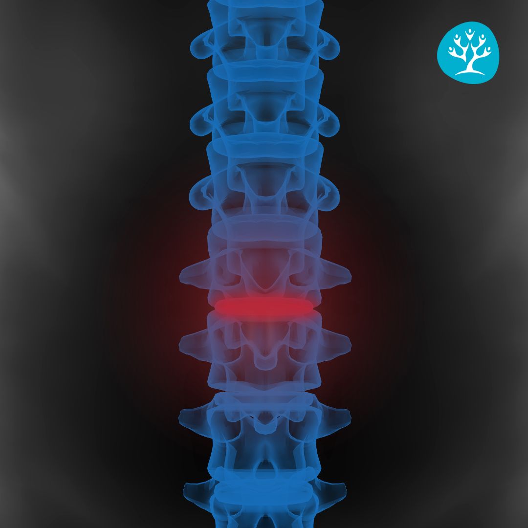 Vertebre Lombari: Anatomia, Funzioni e Prevenzione dei Dolori